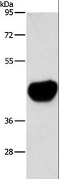 ACTA2 / Smooth Muscle Actin Antibody - Western blot analysis of Mouse heart tissue, using ACTA2 Polyclonal Antibody at dilution of 1:800.