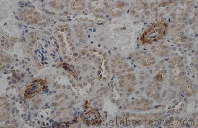 ACTA2 / Smooth Muscle Actin Antibody - Immunohistochemistry of paraffin-embedded mouse kidney using ACTA2 Polyclonal Antibody at dilution of 1:50.