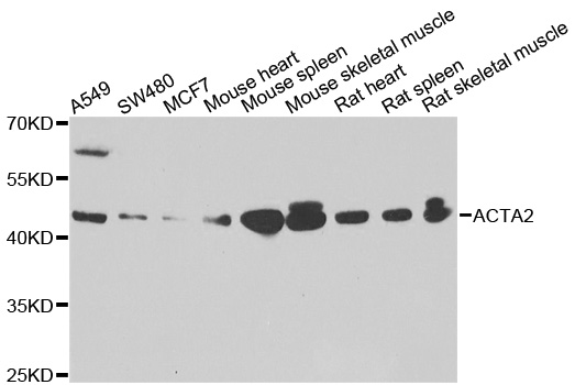 ACTA2 / Smooth Muscle Actin Antibody - Western blot analysis of extracts of various cell lines, using ACTA2 antibody at 1:500 dilution. The secondary antibody used was an HRP Goat Anti-Rabbit IgG (H+L) at 1:10000 dilution. Lysates were loaded 25ug per lane and 3% nonfat dry milk in TBST was used for blocking. An ECL Kit was used for detection and the exposure time was 60s.