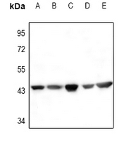 ACTA2 / Smooth Muscle Actin Antibody - Western blot analysis of Actin-pan expression in Hela (A), mouse kidney (B), rat ovary (C), HEK293T (D), A2780 (E) whole cell lysates.