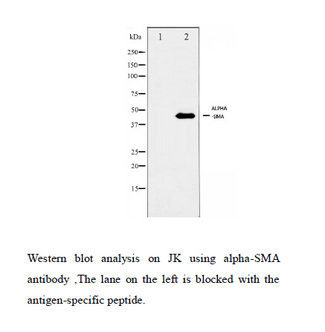 ACTA2 / Smooth Muscle Actin Antibody - Western blot analysis on JK using alpha-SMA antibody. The lane on the left is blocked with the antigen-specific peptide.