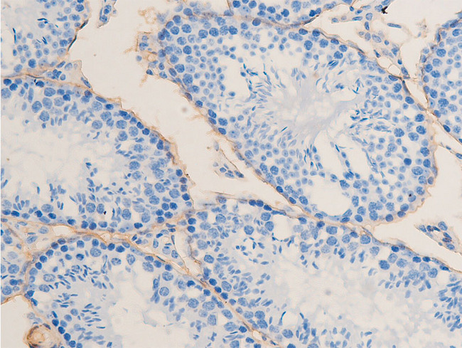 ACTA2 / Smooth Muscle Actin Antibody - 1:100 staining mouse testis tissue by IHC-P. The tissue was formaldehyde fixed and a heat mediated antigen retrieval step in citrate buffer was performed. The tissue was then blocked and incubated with the antibody for 1.5 hours at 22°C. An HRP conjugated goat anti-rabbit antibody was used as the secondary.