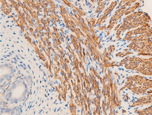 ACTA2 / Smooth Muscle Actin Antibody - 1:100 staining rat uterine tissue by IHC-P. The tissue was formaldehyde fixed and a heat mediated antigen retrieval step in citrate buffer was performed. The tissue was then blocked and incubated with the antibody for 1.5 hours at 22°C. An HRP conjugated goat anti-rabbit antibody was used as the secondary.