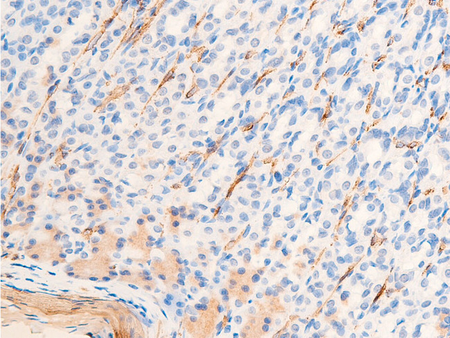ACTA2 / Smooth Muscle Actin Antibody - 1:100 staining rat gastric tissue by IHC-P. The tissue was formaldehyde fixed and a heat mediated antigen retrieval step in citrate buffer was performed. The tissue was then blocked and incubated with the antibody for 1.5 hours at 22°C. An HRP conjugated goat anti-rabbit antibody was used as the secondary.