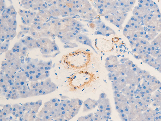 ACTA2 / Smooth Muscle Actin Antibody - 1:100 staining mouse pancreas tissue by IHC-P. The tissue was formaldehyde fixed and a heat mediated antigen retrieval step in citrate buffer was performed. The tissue was then blocked and incubated with the antibody for 1.5 hours at 22°C. An HRP conjugated goat anti-rabbit antibody was used as the secondary.