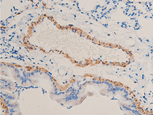 ACTA2 / Smooth Muscle Actin Antibody - 1:100 staining rat lung tissue by IHC-P. The tissue was formaldehyde fixed and a heat mediated antigen retrieval step in citrate buffer was performed. The tissue was then blocked and incubated with the antibody for 1.5 hours at 22°C. An HRP conjugated goat anti-rabbit antibody was used as the secondary.