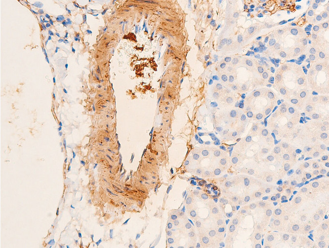 ACTA2 / Smooth Muscle Actin Antibody - 1:100 staining mouse kidney tissue by IHC-P. The tissue was formaldehyde fixed and a heat mediated antigen retrieval step in citrate buffer was performed. The tissue was then blocked and incubated with the antibody for 1.5 hours at 22°C. An HRP conjugated goat anti-rabbit antibody was used as the secondary.
