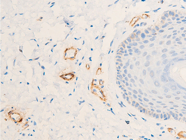 ACTA2 / Smooth Muscle Actin Antibody - 1:100 staining human skin tissue by IHC-P. The tissue was formaldehyde fixed and a heat mediated antigen retrieval step in citrate buffer was performed. The tissue was then blocked and incubated with the antibody for 1.5 hours at 22°C. An HRP conjugated goat anti-rabbit antibody was used as the secondary.