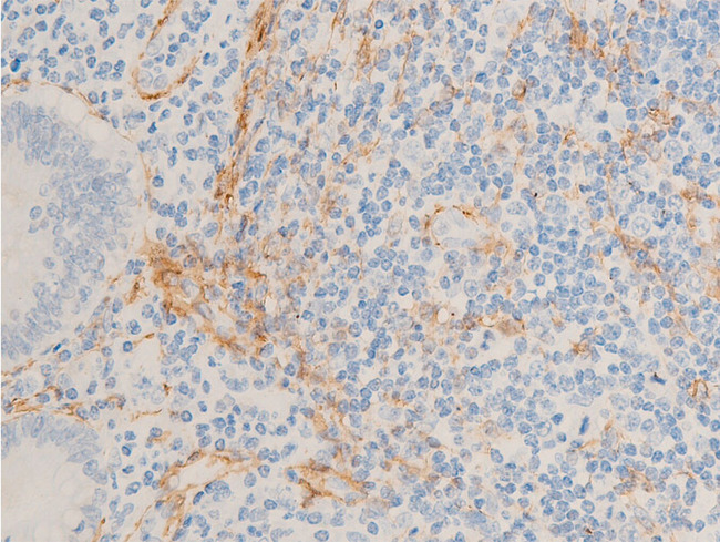 ACTA2 / Smooth Muscle Actin Antibody - 1:100 staining human appendix tissue by IHC-P. The tissue was formaldehyde fixed and a heat mediated antigen retrieval step in citrate buffer was performed. The tissue was then blocked and incubated with the antibody for 1.5 hours at 22°C. An HRP conjugated goat anti-rabbit antibody was used as the secondary.
