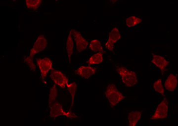 ACTA2 / Smooth Muscle Actin Antibody - Staining HeLa cells by IF/ICC. The samples were fixed with PFA and permeabilized in 0.1% Triton X-100, then blocked in 10% serum for 45 min at 25°C. The primary antibody was diluted at 1:200 and incubated with the sample for 1 hour at 37°C. An Alexa Fluor 594 conjugated goat anti-rabbit IgG (H+L) Ab, diluted at 1/600, was used as the secondary antibody.