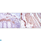 ACTA2 / Smooth Muscle Actin Antibody - Immunohistochemistry (IHC) analysis of paraffin-embedded human duodenum tissues (left) and human esophagus tissues (right) with DAB staining using ACTA2 Monoclonal Antibody.
