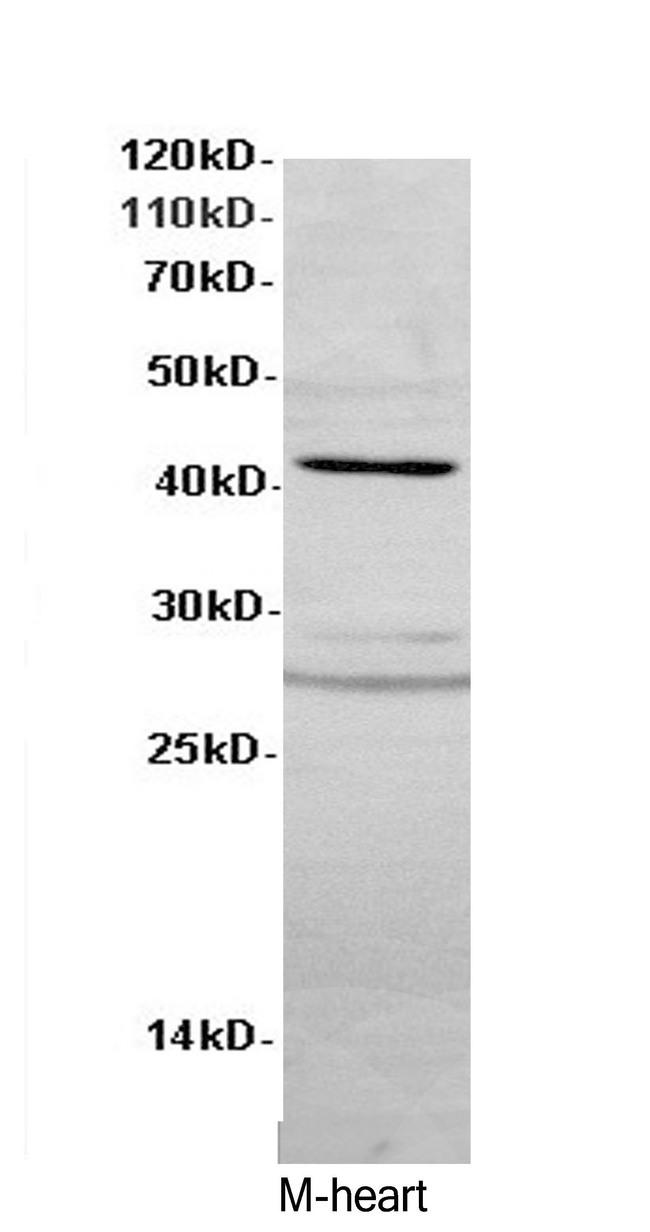 ACTA2 / Smooth Muscle Actin Antibody - Western Blot analysis of Mouse heart using ACTA2 Polyclonal Antibody at dilution of 1:600.