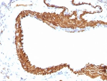 ACTA2 / Smooth Muscle Actin Antibody - Formalin-fixed, paraffin-embedded rat lung stained with ACTA2 antibody (1A4 + ACTA2/791).  This image was taken for the unmodified form of this product. Other forms have not been tested.