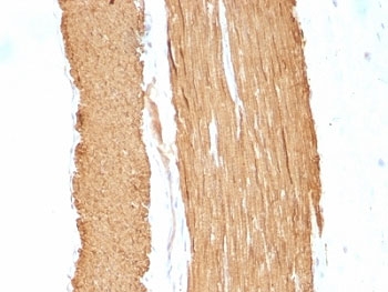 ACTA2 / Smooth Muscle Actin Antibody - Formalin-fixed, paraffin-embedded rat stomach stained with ACTA2 antibody.  This image was taken for the unmodified form of this product. Other forms have not been tested.