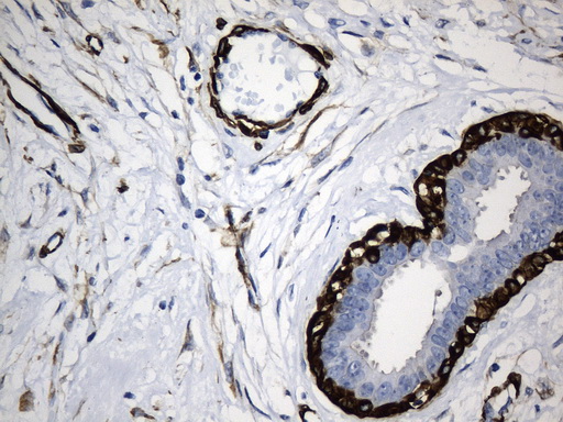 ACTA2 / Smooth Muscle Actin Antibody - Immunohistochemical staining of paraffin-embedded Human breast tissue within the normal limits using anti-ACTA2. (smooth muscle actin alpha, SMA) mouse monoclonal antibody. (Heat-induced epitope retrieval by 1mM EDTA in 10mM Tris buffer. (pH8.5) at 120°C for 3 min. (1:3200)