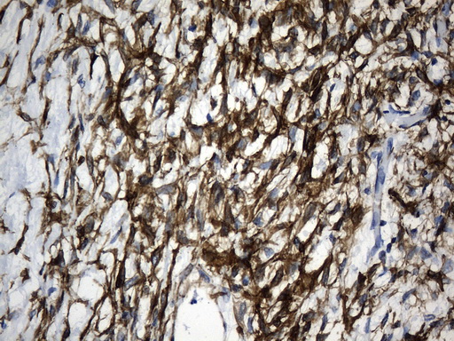 ACTA2 / Smooth Muscle Actin Antibody - Immunohistochemical staining of paraffin-embedded Human Ovary tissue within the normal limits using anti-ACTA2. (smooth muscle actin alpha, SMA) mouse monoclonal antibody. (Heat-induced epitope retrieval by 1mM EDTA in 10mM Tris buffer. (pH8.5) at 120°C for 3 min. (1:3200)