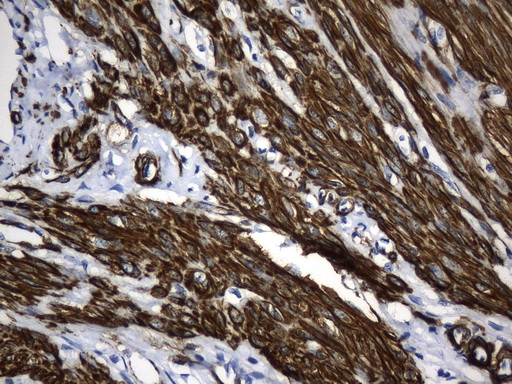 ACTA2 / Smooth Muscle Actin Antibody - Immunohistochemical staining of paraffin-embedded Human endometrium tissue within the normal limits using anti-ACTA2. (smooth muscle actin alpha, SMA) mouse monoclonal antibody. (Heat-induced epitope retrieval by 1mM EDTA in 10mM Tris buffer. (pH8.5) at 120°C for 3 min. (1:3200)