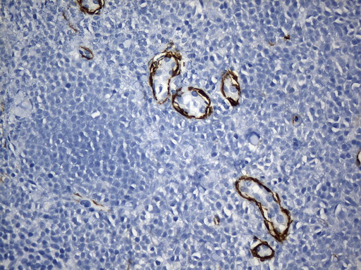 ACTA2 / Smooth Muscle Actin Antibody - Immunohistochemical staining of paraffin-embedded Human lymph node tissue within the normal limits using anti-ACTA2. (smooth muscle actin alpha, SMA) mouse monoclonal antibody. (Heat-induced epitope retrieval by 1mM EDTA in 10mM Tris buffer. (pH8.5) at 120°C for 3 min. (1:3200)