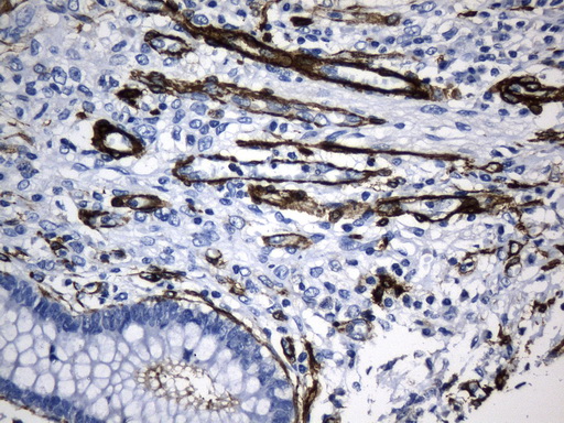 ACTA2 / Smooth Muscle Actin Antibody - Immunohistochemical staining of paraffin-embedded Human colon tissue within the normal limits using anti-ACTA2. (smooth muscle actin alpha, SMA) mouse monoclonal antibody. (Heat-induced epitope retrieval by 1mM EDTA in 10mM Tris buffer. (pH8.5) at 120°C for 3 min. (1:3200)
