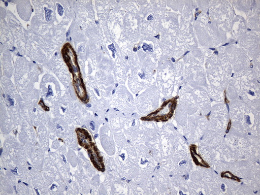 ACTA2 / Smooth Muscle Actin Antibody - Immunohistochemical staining of paraffin-embedded Human uterine smooth muscle tissue using anti-ACTA2. (smooth muscle actin alpha, SMA) mouse monoclonal antibody. (Heat-induced epitope retrieval by 1mM EDTA in 10mM Tris buffer. (pH8.5) at 120 oC for 3 min. (1:3200)