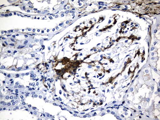 ACTA2 / Smooth Muscle Actin Antibody - Immunohistochemical staining of paraffin-embedded Human Kidney tissue within the normal limits using anti-ACTA2. (smooth muscle actin alpha, SMA) mouse monoclonal antibody. (Heat-induced epitope retrieval by 1mM EDTA in 10mM Tris buffer. (pH8.5) at 120°C for 3 min. (1:3200)