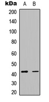 ACTA2 / Smooth Muscle Actin Antibody - Western blot analysis of Smooth Muscle Actin expression in MCF7 (A); K562 (B) whole cell lysates.