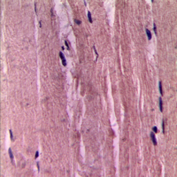 ACTA2 / Smooth Muscle Actin Antibody - Immunohistochemical analysis of Smooth Muscle Actin staining in human skeletal muscle formalin fixed paraffin embedded tissue section. The section was pre-treated using heat mediated antigen retrieval with sodium citrate buffer (pH 6.0). The section was then incubated with the antibody at room temperature and detected using an HRP conjugated compact polymer system. DAB was used as the chromogen. The section was then counterstained with hematoxylin and mounted with DPX. w