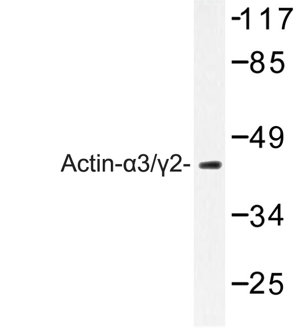 ACTA3 / ACTG2 Antibody - Western blot of Actin-3/2 (E2) pAb in extracts from COLO205 cells.