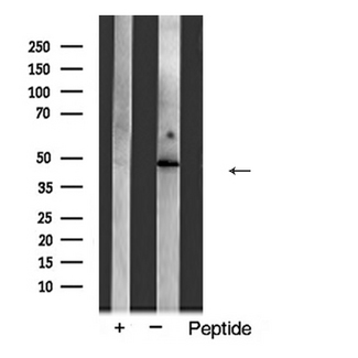 ACTA3 / ACTG2 Antibody - Western blot analysis of Actin gamma2 expression in COLO205 cells