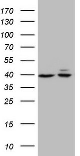 ACTB / Beta Actin Antibody - HEK293T cells were transfected with the pCMV6-ENTRY control (Left lane) or pCMV6-ENTRY ACTB (Right lane) cDNA for 48 hrs and lysed. Equivalent amounts of cell lysates (5 ug per lane) were separated by SDS-PAGE and immunoblotted with Rabbit polyclonal anti-ACTB antibody at 1:500 dilution.