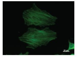 ACTB / Beta Actin Antibody - Immunofluorescent staining using ACTB antibody. Immunostaining analysis in HeLa cells. HeLa cells were fixed with 4% paraformaldehyde and permeabilized with 0.01% Triton-X100 in PBS. The cells were immunostained with anti-ACTB antibody.
