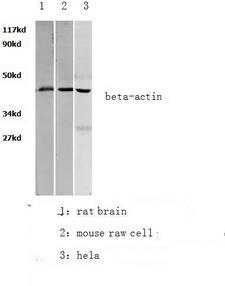 ACTB / Beta Actin Antibody - Western blot of -actin pAb in extracts from HEK293A cells, Rat liver and mouse lung tissues.