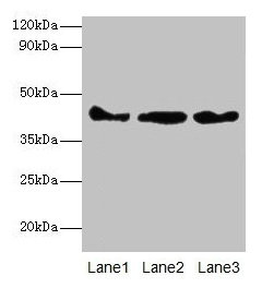 ACTB / Beta Actin Antibody - Western blot All lanes: Actin, cytoplasmic 1 antibody at 2µg/ml Lane 1: Mouse spleen tissue Lane 2: 293T whole cell lysate Lane 3: Hela whole cell lysate Secondary Goat polyclonal to rabbit IgG at 1/10000 dilution Predicted band size: 42 kDa Observed band size: 42 kDa