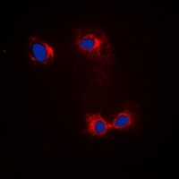 ACTB / Beta Actin Antibody - Immunofluorescent analysis of Beta-actin staining in HeLa cells. Formalin-fixed cells were permeabilized with 0.1% Triton X-100 in TBS for 5-10 minutes and blocked with 3% BSA-PBS for 30 minutes at room temperature. Cells were probed with the primary antibody in 3% BSA-PBS and incubated overnight at 4 deg C in a humidified chamber. Cells were washed with PBST and incubated with a FITC-conjugated secondary antibody (green) in PBS at room temperature in the dark. DAPI was used to stain the cell nuclei (blue).