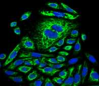 ACTB / Beta Actin Antibody - Detection of beta-actin in HeLa cells with Beta-Actin Polyclonal Antibody at 10ug/ml. DAPI (blue) nuclear stain and FITC (green) beta-actin stain.