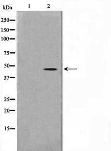 ACTB / Beta Actin Antibody - Western blot analysis on HeLa cell lysates using Actin-pan antibody. The lane on the left is treated with the antigen-specific peptide.