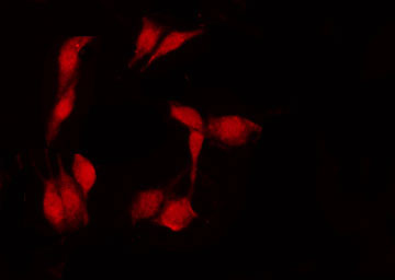 ACTB / Beta Actin Antibody - Staining HeLa cells by IF/ICC. The samples were fixed with PFA and permeabilized in 0.1% Triton X-100, then blocked in 10% serum for 45 min at 25°C. The primary antibody was diluted at 1:200 and incubated with the sample for 1 hour at 37°C. An Alexa Fluor 594 conjugated goat anti-rabbit IgG (H+L) Ab, diluted at 1/600, was used as the secondary antibody.