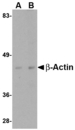 ACTB / Beta Actin Antibody - Western blot of actin in HeLa cell lysate with beta-actin antibody at (A) 1 and (B) 2 ug/ml