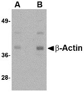 ACTB / Beta Actin Antibody - Western blot of actin in HeLa cell lysate with b-actin antibody at (A) 1 and (B) 2 ug/ml