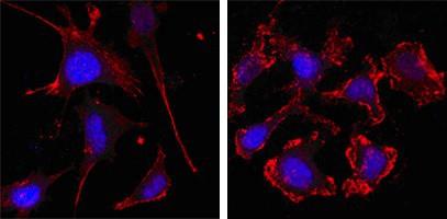 ACTB / Beta Actin Antibody - Immunocytochemistry/Immunofluorescence: Beta Actin Antibody (8H10D10) - Confocal immunofluorescence analysis of SK-BR-3 (left) and A549 (right) cells using anti-Beta Actin mAb (red, the secondary Ab is Cy3-Goat anti mouse IgG). Blue: DRAQ5 fluorescent DNA dye.