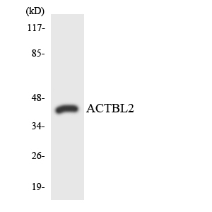 ACTBL2 Antibody - Western blot analysis of the lysates from HUVECcells using ACTBL2 antibody.