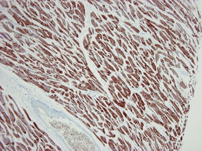 ACTC1 / Alpha Cardiac Actin Antibody - Paraffin section of human cardiac muscle immunostained with 22D3 1 500