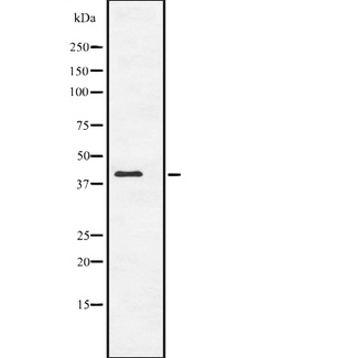 ACTC1 / Alpha Cardiac Actin Antibody - Western blot analysis of ACTC1 expression in NIH3T3 whole cells lysate. The lane on the left is treated with the antigen-specific peptide.