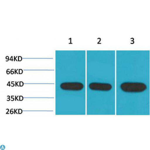 ACTC1 / Alpha Cardiac Actin Antibody - Western Blot (WB) analysis of 1) HeLa, 2) 3T3, 3) Rat Brain using alpha-SMA Monoclonal Antibody.