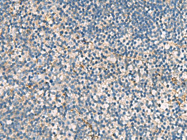 ACTC1 / Alpha Cardiac Actin Antibody - Immunohistochemistry of paraffin-embedded Human tonsil tissue  using ACTC1 Polyclonal Antibody at dilution of 1:55(×200)