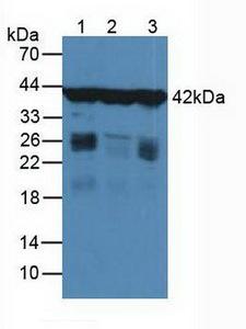 ACTG1 / Gamma Actin Antibody - Western Blot; Sample: Lane1: Human Liver Tissue; Lane2: Human Hela Cells.