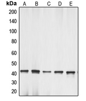 ACTG1 / Gamma Actin Antibody - Western blot analysis of Gamma-actin-1 expression in HeLa (A); Raw264.7 (B); PC12 (C); L929 (D); C6 (E) whole cell lysates.