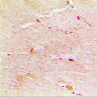 ACTG1 / Gamma Actin Antibody - Immunohistochemical analysis of Gamma-actin-1 staining in human muscle formalin fixed paraffin embedded tissue section. The section was pre-treated using heat mediated antigen retrieval with sodium citrate buffer (pH 6.0). The section was then incubated with the antibody at room temperature and detected using an HRP conjugated compact polymer system. DAB was used as the chromogen. The section was then counterstained with hematoxylin and mounted with DPX.
