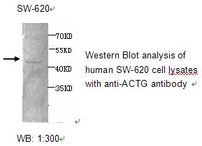 ACTG1 / Gamma Actin Antibody