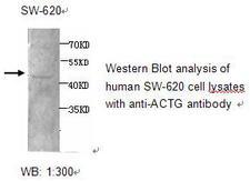 ACTG1 / Gamma Actin Antibody